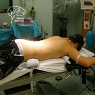 Patient spine Surgery lying face down, protecting his face with baseball Catcher.